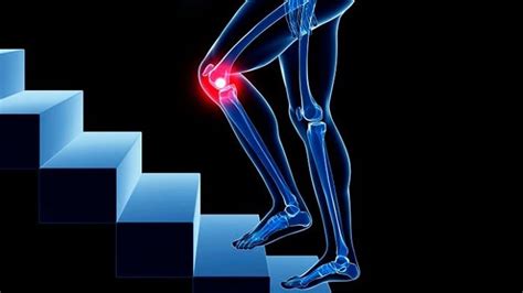 артроза на гимнастиката на колянната става при лечение на гонартроза